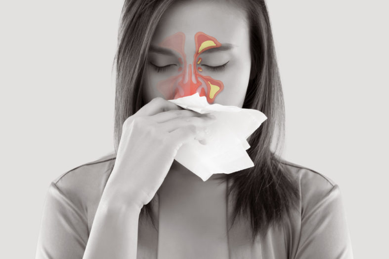Natürliche Heilmittel bei Allergien